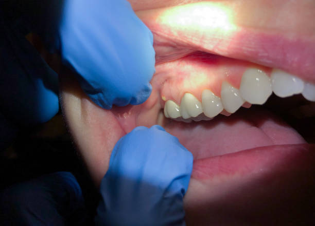 Best Holiday Emergency Dentist in Lexington, VA