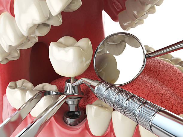 Best Emergency Dentist for Special Needs Patients in Lexington, VA